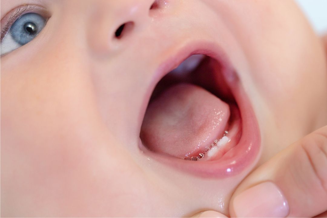 Lolly_dentinhos_ Como cuidar dos primeiros dentinhos - Lolly Brasil